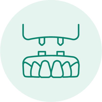 Teeth in a Day Procedure Icon