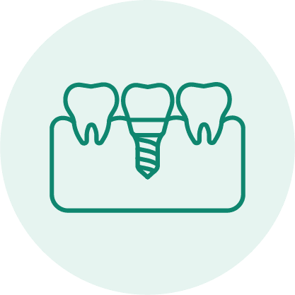 Bone Grafting Procedure Icon